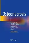 Osteonecrosis cover
