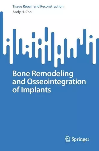 Bone Remodeling and Osseointegration of Implants cover