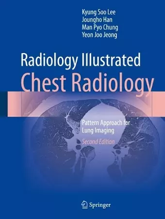 Radiology Illustrated: Chest Radiology cover