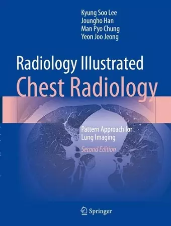 Radiology Illustrated: Chest Radiology cover