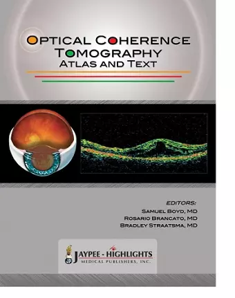 Optical Coherence Tomography cover