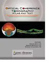 Optical Coherence Tomography cover