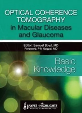 Optical Coherence Tomography in Macular Diseases and Glaucoma: Basic Knowledge cover