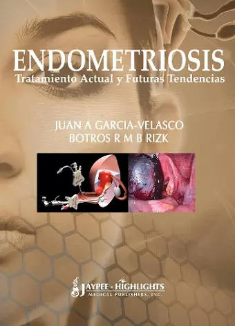 Endometriosis: Tratamiento Actual y Futuras Tendencias cover