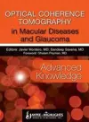 Optical Coherence Tomography in Macular Diseases and Glaucoma: Advanced Knowledge cover