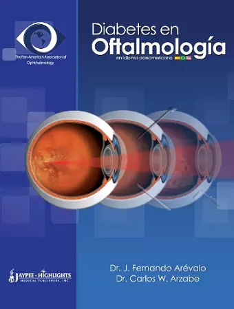 Diabetes en Oftalmología cover