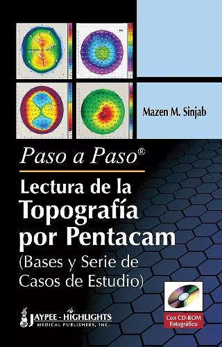 Paso a Paso - Lectura de la Topografía por Pentacam cover