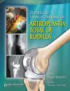 Dominio de Técnicas Ortopédicas: Artroplastía Total de Rodilla cover