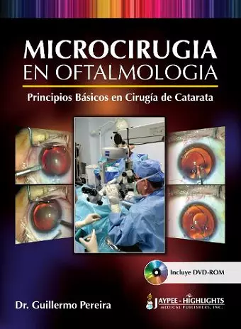 Microcirugía en Oftalmología: Principios Básicos en Cirugía de Catarata cover