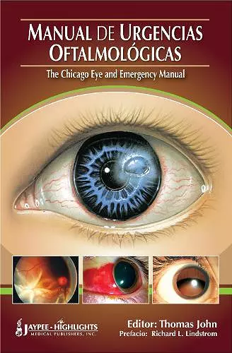 Manual de Urgencias Oftalmológicas - "The Chicago Eye and Emergency Manual" cover