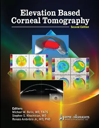 Elevation Based Corneal Tomography cover