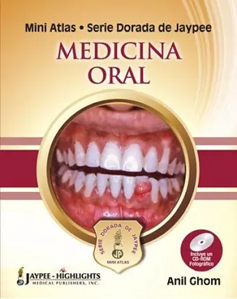 Mini Atlas Serie Dorada de Jaypee: Medicina Oral cover