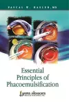 Essential Principles of Phacoemulsification cover