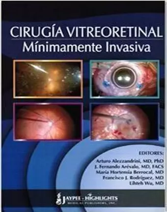 Cirugía Vitreoretinal Mínimamente Invasiva cover