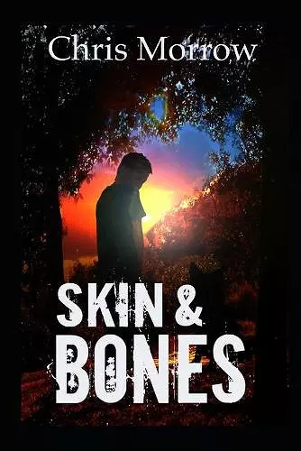 Skin & Bones cover