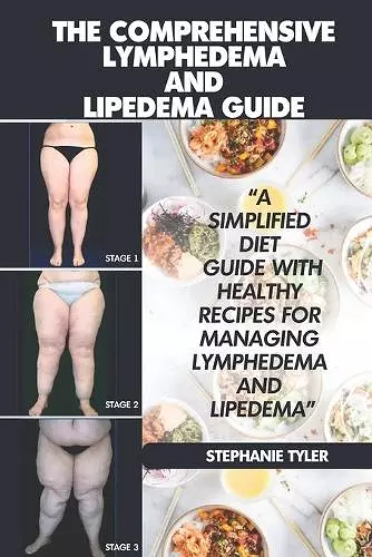 The Comprehensive Lymphedema and Lipedema Guide cover