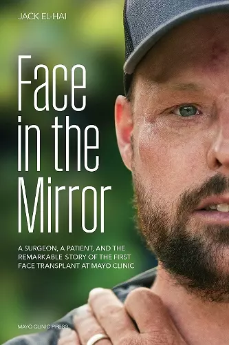 Face Transplant cover
